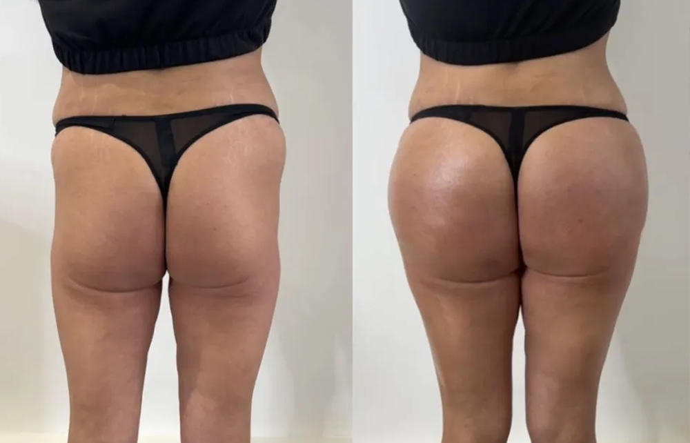 Luvora Breast & Hip Enhancing Cream